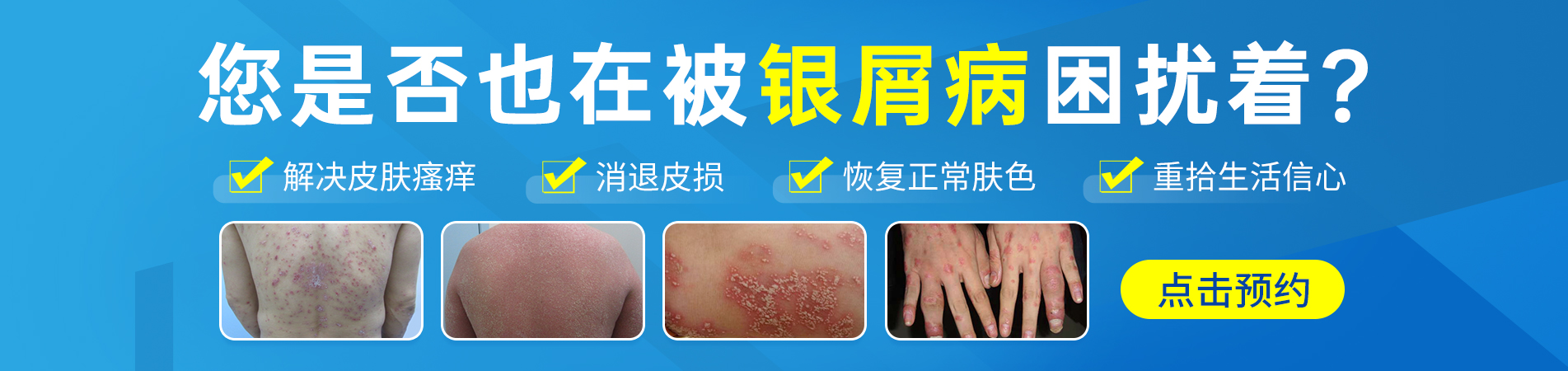长沙博润银屑病医院